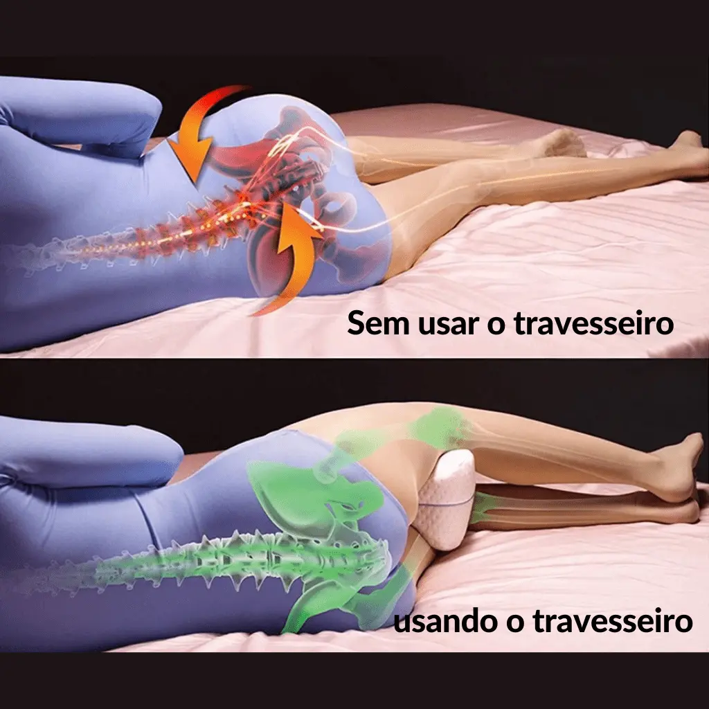 Almofada-Anatômica-Apoio-Postural-SonoLeve-diferenças